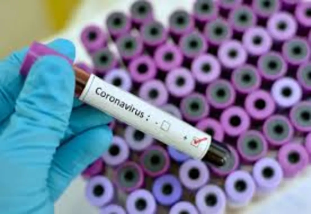 Bilanț coronavirus: Peste 3.500 de infectări în ultimele 24 de ore