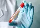 Bilanț coronavirus: 12.474 de cazuri noi de persoane infectate cu SARS – CoV – 2